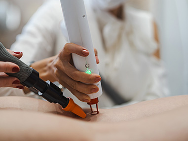 Aplicação de laser transdérmico sobre a pele da perna, com soprador de ar frio para conforto da paciente