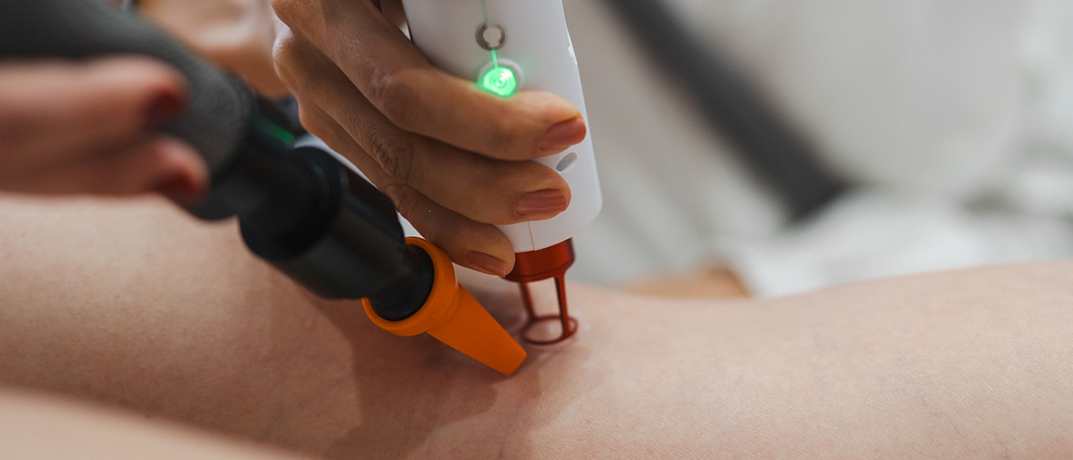 Aplicação de laser em vasinhos, com uso de óculos de proteção